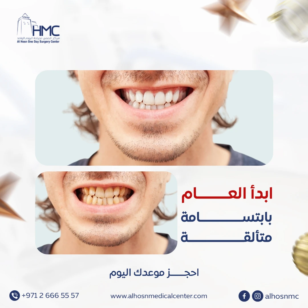 Al Hosn One Day Surgery Center