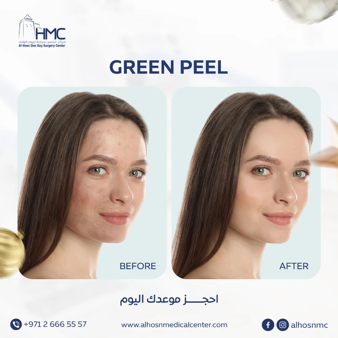 Al Hosn One Day Surgery Center